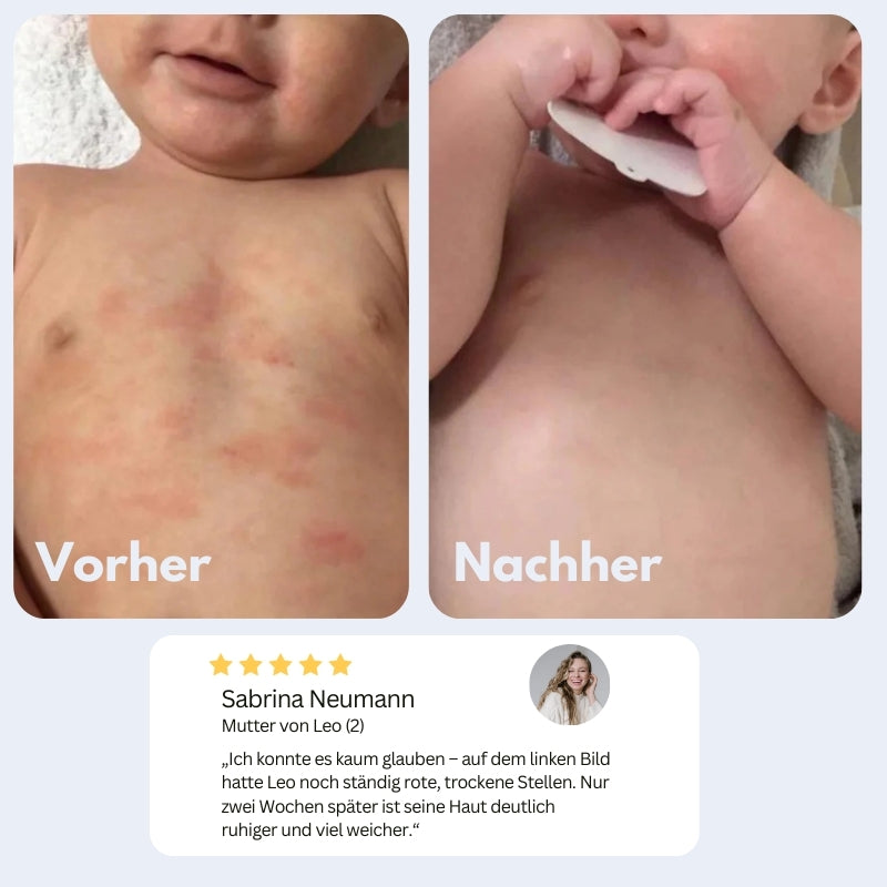 Pluumi™ - sanftes Wasser, zarte Kinderhaut